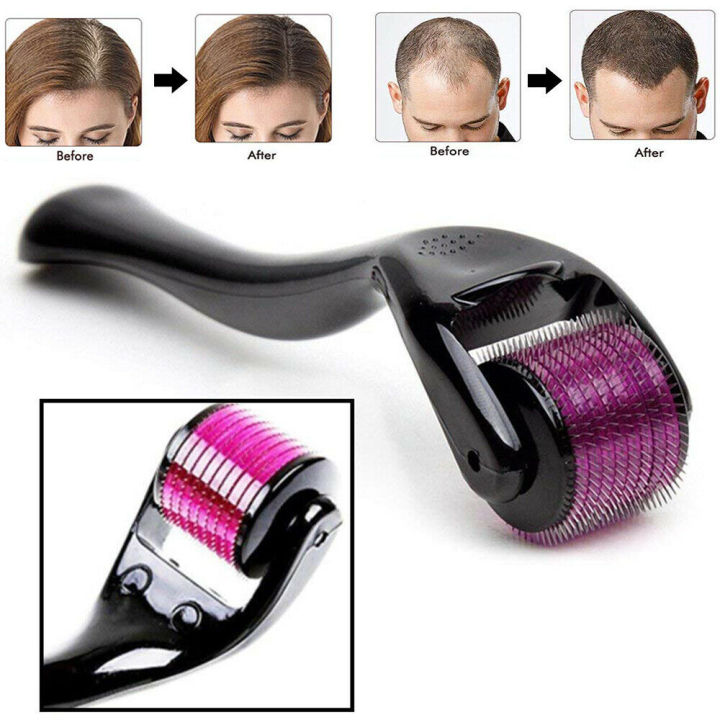 Derma Roller | Acne Scars Treatment | 540 Needles ( 0.5mm)
